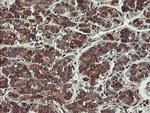 VBP1 Antibody in Immunohistochemistry (Paraffin) (IHC (P))