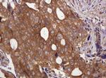 VBP1 Antibody in Immunohistochemistry (Paraffin) (IHC (P))