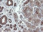 VBP1 Antibody in Immunohistochemistry (Paraffin) (IHC (P))