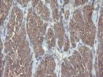 VBP1 Antibody in Immunohistochemistry (Paraffin) (IHC (P))