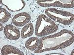 VBP1 Antibody in Immunohistochemistry (Paraffin) (IHC (P))