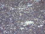 VBP1 Antibody in Immunohistochemistry (Paraffin) (IHC (P))