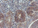 VBP1 Antibody in Immunohistochemistry (Paraffin) (IHC (P))