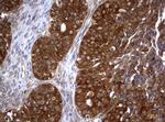 VBP1 Antibody in Immunohistochemistry (Paraffin) (IHC (P))