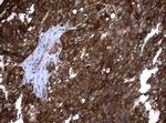 VBP1 Antibody in Immunohistochemistry (Paraffin) (IHC (P))