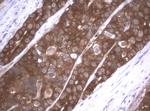 VBP1 Antibody in Immunohistochemistry (Paraffin) (IHC (P))