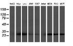 VBP1 Antibody in Western Blot (WB)