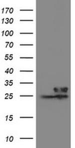 VBP1 Antibody in Western Blot (WB)