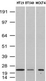 VBP1 Antibody in Western Blot (WB)