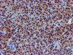 VCAM1 Antibody in Immunohistochemistry (Paraffin) (IHC (P))