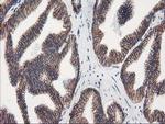 VCAM1 Antibody in Immunohistochemistry (Paraffin) (IHC (P))