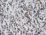 VCAM1 Antibody in Immunohistochemistry (Paraffin) (IHC (P))