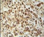 VCX Antibody in Immunohistochemistry (IHC)