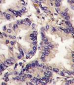 VEGFC Antibody in Immunohistochemistry (IHC)