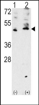 VEGFC Antibody in Western Blot (WB)