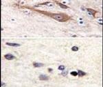 VSNL1 Antibody in Immunohistochemistry (IHC)