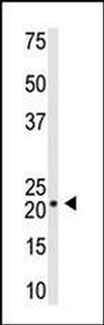 VSNL1 Antibody in Western Blot (WB)