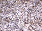 VIM Antibody in Immunohistochemistry (Paraffin) (IHC (P))