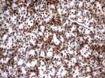 VIM Antibody in Immunohistochemistry (Paraffin) (IHC (P))