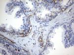 VIM Antibody in Immunohistochemistry (Paraffin) (IHC (P))