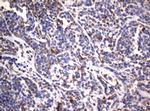 VIM Antibody in Immunohistochemistry (Paraffin) (IHC (P))