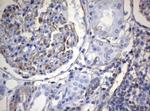 VIM Antibody in Immunohistochemistry (Paraffin) (IHC (P))