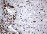 VIM Antibody in Immunohistochemistry (Paraffin) (IHC (P))