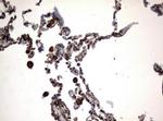 VIM Antibody in Immunohistochemistry (Paraffin) (IHC (P))