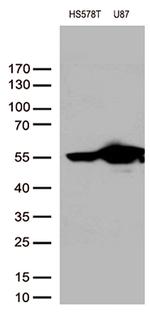 VIM Antibody in Western Blot (WB)