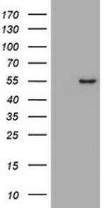 VIM Antibody in Western Blot (WB)