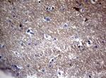 VSNL1 Antibody in Immunohistochemistry (Paraffin) (IHC (P))