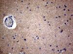 VSNL1 Antibody in Immunohistochemistry (Paraffin) (IHC (P))