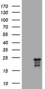 VSNL1 Antibody in Western Blot (WB)