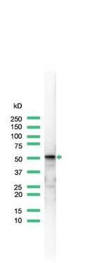 Vimentin Antibody in Western Blot (WB)