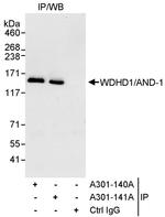 WDHD1/AND-1 Antibody in Immunoprecipitation (IP)
