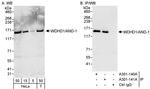 WDHD1/AND-1 Antibody in Western Blot (WB)