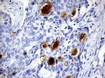 WFDC2 Antibody in Immunohistochemistry (Paraffin) (IHC (P))