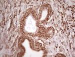 WIBG Antibody in Immunohistochemistry (Paraffin) (IHC (P))