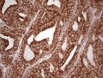 WIBG Antibody in Immunohistochemistry (Paraffin) (IHC (P))