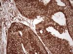 WIBG Antibody in Immunohistochemistry (Paraffin) (IHC (P))