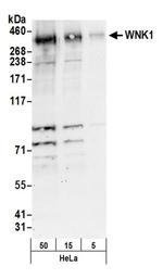WNK1 Antibody in Western Blot (WB)