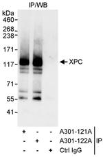 XPC Antibody in Immunoprecipitation (IP)