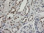 XPF Antibody in Immunohistochemistry (Paraffin) (IHC (P))