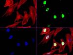 XRCC1 Antibody in Immunocytochemistry (ICC/IF)