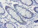 XRCC1 Antibody in Immunohistochemistry (Paraffin) (IHC (P))