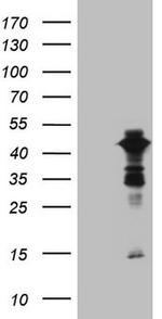 XRCC3 Antibody in Western Blot (WB)