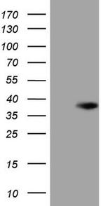 XRCC6BP1 Antibody in Western Blot (WB)