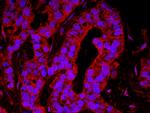 YAP1 Antibody in Immunohistochemistry (IHC)