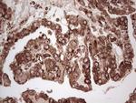 YBX1 Antibody in Immunohistochemistry (Paraffin) (IHC (P))