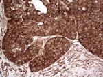 YBX1 Antibody in Immunohistochemistry (Paraffin) (IHC (P))